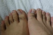 【閲覧注意】なんJ民の足の爪、エグすぎる wwwwwwwwwwwwwww