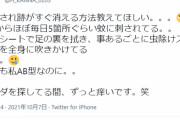 【衝撃】橋本環奈さんが虫刺され跡がすぐ消える方法を募集した結果ｗｗｗｗｗｗｗｗｗ