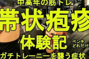 【健康】20代～40代で発症者が増加「帯状疱疹」疲れやストレスで“免疫低下”しがちな年度末は特に注意