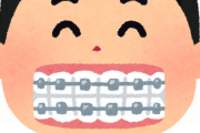 歯列矯正1日目ワイ、発狂。