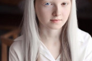 【画像】アルビノでオッドアイのロシア少女wwwwwwwwwwwwwwwwwww