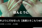 【悲報】引きこもりの爪、ヤバイ