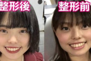 【画像】お笑いトリオ「ぼる塾はるか」さん、整形していたｗｗ