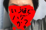 【画像】25歳なんだがハゲ診断してくれｗｗｗ