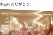 【画像】風俗嬢「なぜか妊娠した、心当たりがコレしかないんですが…みんな気を付けて」