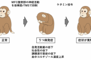 世界初、磁場による脳刺激でサルを人工的に「うつ病」にすることに成功（東北大）