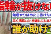 【バカ】指輪が抜けない助けて…【2ch面白いスレ】