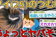 【ハゲ】ワイの髪が将来ハゲるか判断してくれｗｗｗｗ→この手のスレで初めて”マジ”のやつ見たわｗｗｗｗ【2ch面白いスレ】