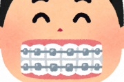 歯の矯正とかいう育ちの良い奴がさせてもらえる高額治療ｗｗｗｗｗｗｗｗｗｗｗｗ