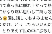 【画像あり】保育園の先生、園児の顔を激落ちくんで擦ってしまう