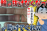 【2ch面白いスレ】指輪が抜けない。誰か助けてwwww【ゆっくり解説】