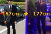 【朗報】手術で身長を10cm延ばした男、めちゃくちゃスーツが似合うようになる