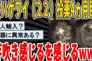 【2ch面白いスレ】【朗報】若ハゲワイ(22)、投薬4ヶ月目で遂に芽吹きを感じる。wwwww　聞き流し/2ch天国