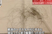 【画像あり】コロナ禿げ、結構キツい