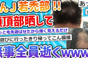 【2ch面白いスレ】床屋から「ちょっと薄くなってきてるかもしれません」と言われて写真撮ったから見てくれ