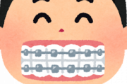 【朗報】歯列矯正しようとした結果ｗｗｗｗ
