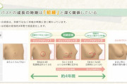 【画像】ワコール「女の子の胸が膨らむ過程を解説します」