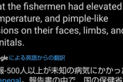 【速報】セネガルで謎の感染症が発生！！！？