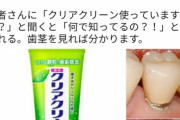 【悲報】歯科衛生士「クリアクリーンはオススメしない」