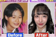 【画像】１２年間で整形１００回の女さん、人生アップデートしまくりｗｗｗ