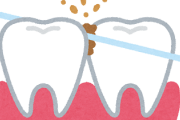 有識者「デンタルフロスは絶対やれ！」 ワイ「えぇ…めんど…」