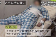 【画像】12歳少女、肛門に異物を入れるのをやめられないためベッドに拘束されてしまう