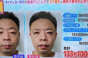 【画像】ダイアンユースケ、まさかの整形ｗｗｗｗｗｗ
