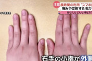 【悲報】"スマホ指"、ガチで社会問題へ……(´・ω:;.:...