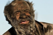 【画像】60年間身体を洗ったことのない男の見た目が凄いｗｗｗ