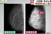 【悲報】女さん「乳ガンは嘘の病気だ！」ww←ふぁあっw