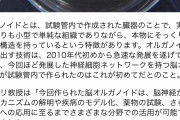 【画像】iPS細胞でミニ脳を開発 赤ちゃんに近い脳波を検出 意識はあるのか？ 脳だけ人間誕生ｗｗｗｗｗｗｗｗｗｗｗｗｗｗｗｗｗｗｗｗｗｗｗｗｗ