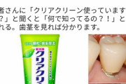 【悲報】歯科衛生士「クリアクリーンはオススメしない」