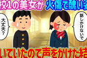 【2ch馴れ初め】学校1の美女が顔に火傷して醜い姿に…ある日泣いていたので声をかけた結果…【ゆっくり】