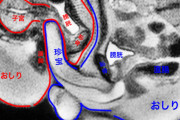MRIで撮影されたSEXの画像が凄いwwww
