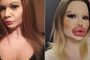 【画像】白人美女、整形しすぎてとんでもない顔になってしまう お前らの想像の50倍はとんでもない