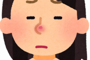 【緊急】イチゴ鼻の治し方ｗｗｗｗｗｗｗｗ
