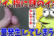【2ch面白いスレ】ワイの指、謎のイボが大量発生してしまうwwww【ゆっくり解説】