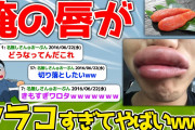 俺の唇がタラコすぎてやばい【2ch面白いスレ】