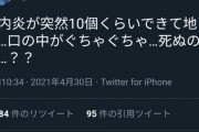 【悲報】大人気声優の鬼頭明里さん、突然口内炎が10個もできてしまう