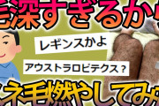【2ch面白スレ】ワイより毛深いヤツいるなら来いよw→毛深すぎてすね毛を燃やしてみた結果ｗｗ【ゆっくり解説】