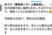 【ｼｺｯ♡】顔整形と骨延長した元チー牛ホスト、けつなあな確定「お尻使ってください♡」