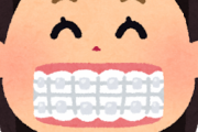 【必見】ワイが『歯の矯正』をやるか迷う理由がコレｗｗｗ