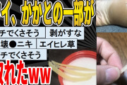 【2ch面白いスレ】ワイ、かかとの一部が取れたwwwww　聞き流し/2ch天国