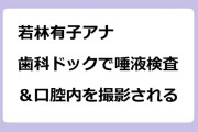 若林有子アナ　歯科ドックで唾液検査＆口腔内を撮影される