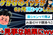 【悲報】ハゲかけのイッチがハゲ対策で6ヶ月間、湯シャン続けた結果www【2ch面白いスレ】