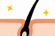 髪の毛穴から粒が取れるんやが.....