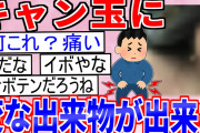 【2ch面白いスレ】キャン玉に変な出来物が出来たんだけど、何これ？【ゆっくり解説】