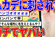 【2ch面白いスレ】ムカデに刺されたワイの足、ガチでヤバいことになる