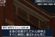 3歳男児に熱湯を浴びせ殺害か・・・母親の交際相手逮捕(2021年9月22日)