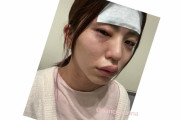 金属アレルギーのぱんちゃん璃奈、異物混入ワクチンと同ロット接種でまぶたや唇も腫れ呼吸困難に…救急搬送明かす
